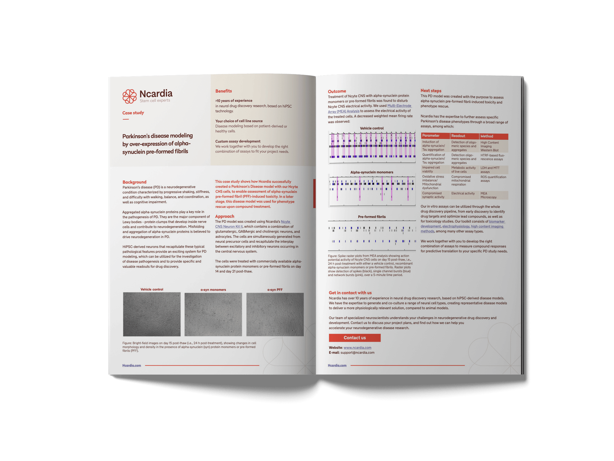 Case Study- Parkinson_s Disease Modeling